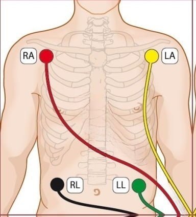ads1192-ecg-connection