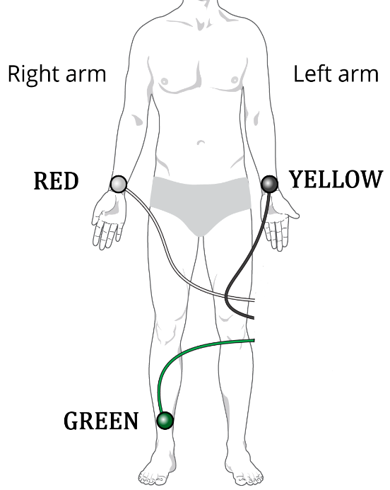 ads1191-body